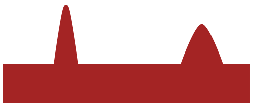 Nuolatinis skausmas su retkarčiais pasikartojančiais skausmo priepuoliais